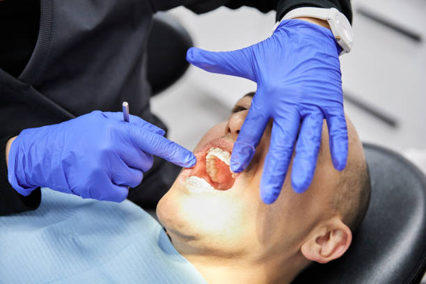 Best Emergency Broken Tooth Repair in Nixa, MO