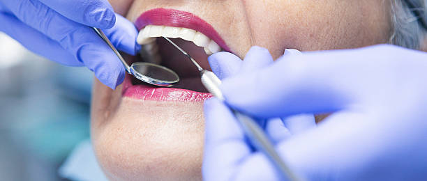 Best Walk-In Emergency Dentist in Nixa, MO